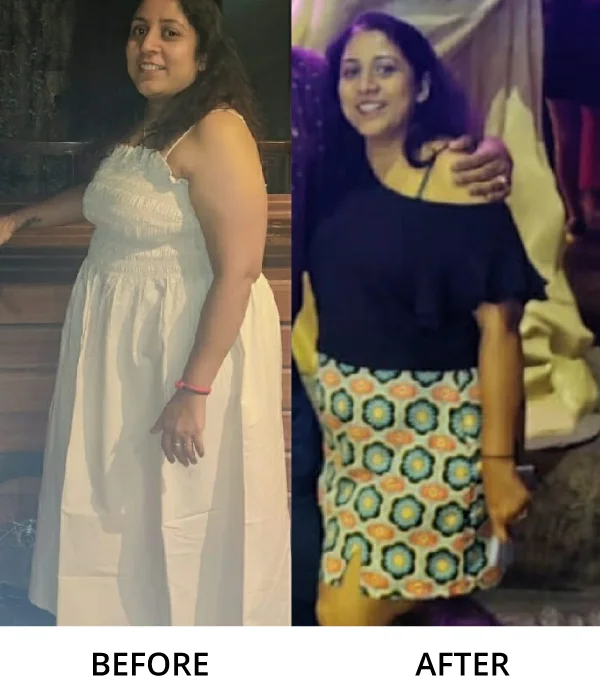 Before After Diet n Cure