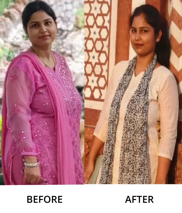 Before After Diet n Cure