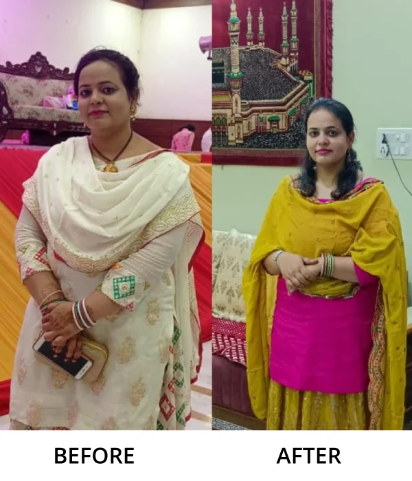 Before After Diet n Cure