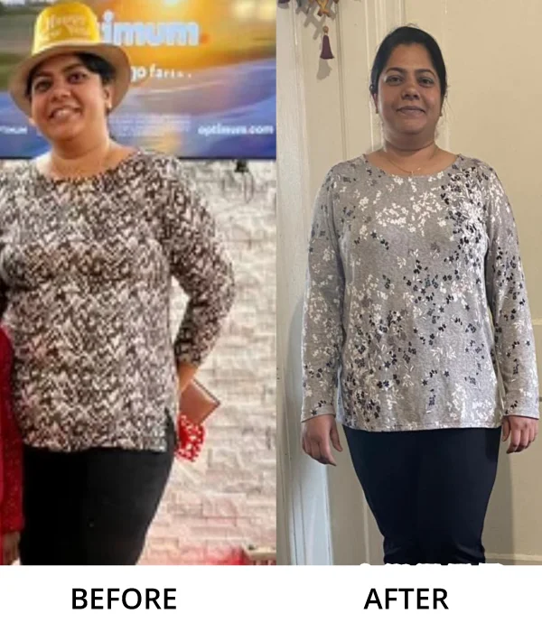 Before After Diet n Cure